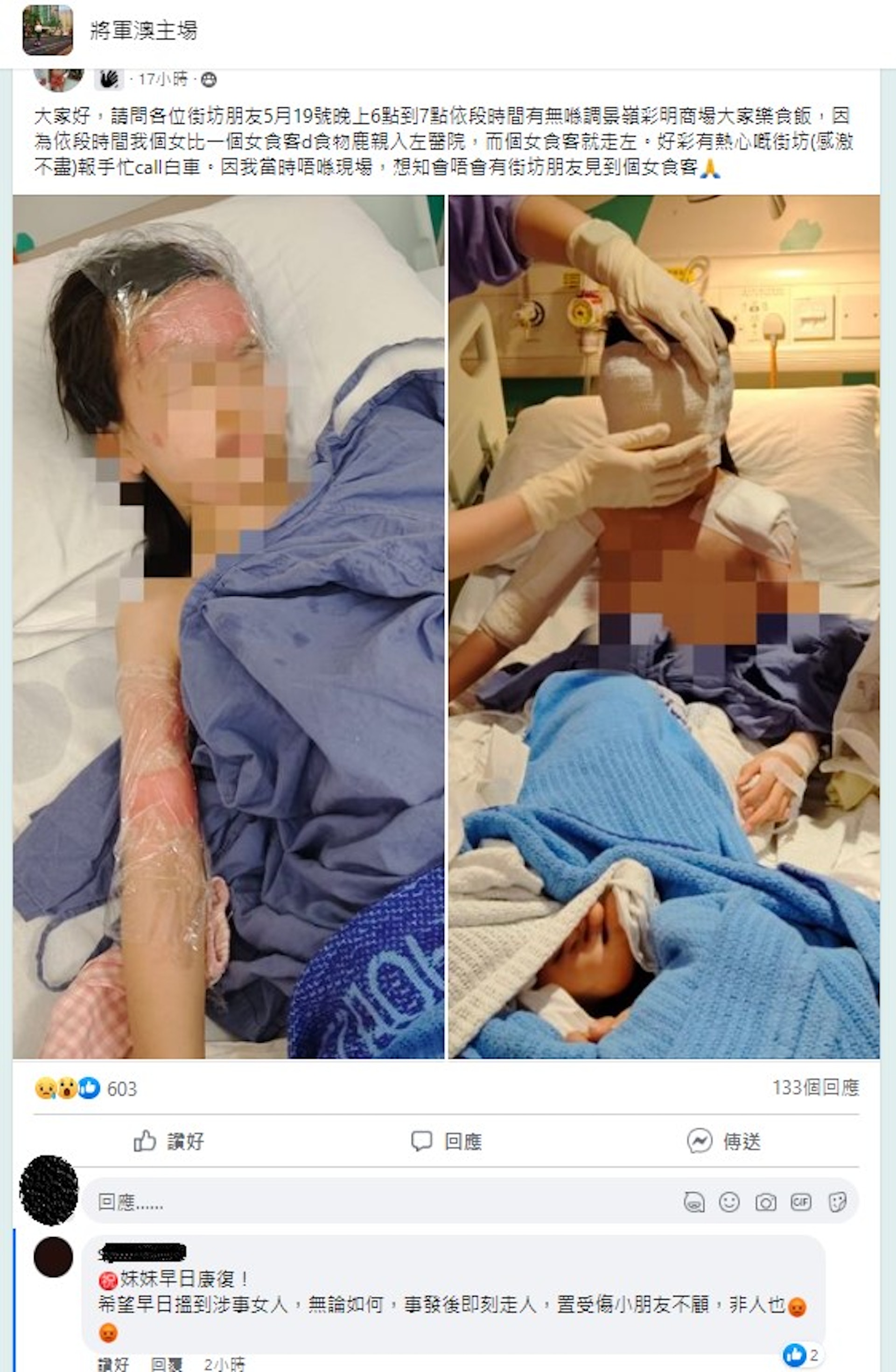 8歲女童意外遭熱咖啡照頭淋，大片前額及手臂被二級燙傷留醫，其父親不忿涉事女食客在事發後「不顧而去」，在Facebook群組發帖文尋找目擊者及追查女食客下落，盼為女兒討公道。(畫面截自Facebook群組「將軍澳主場」)